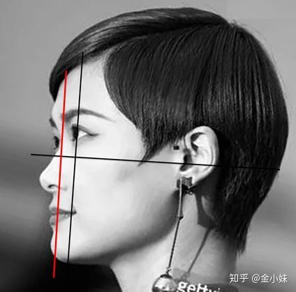 明星颌面问题,美丽背后的健康隐患